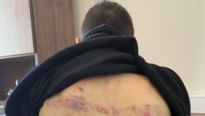 После ареста в Беларуси силовики вывезли стендап-комика Останина в лес и избили, сломав позвоночник — Меркачева
